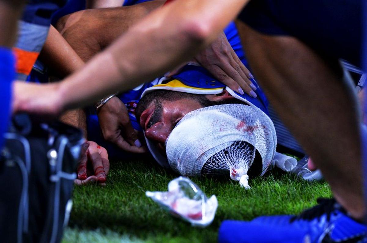 DINAMO - FC BOTOȘANI 1-1 // UPDATE+FOTO Ce diagnostic i-au pus medicii lui Moussa după ciocnirea cu Pap » Atenție, imagini dure cu accidentarea!