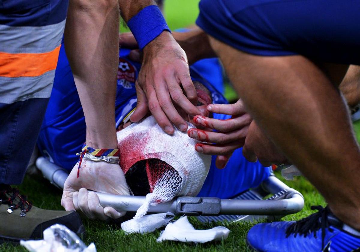 DINAMO - FC BOTOȘANI 1-1 // Atenție, imagini dure! Jucătorii au înmărmurit după ciocnirea horror dintre Moussa și Pap