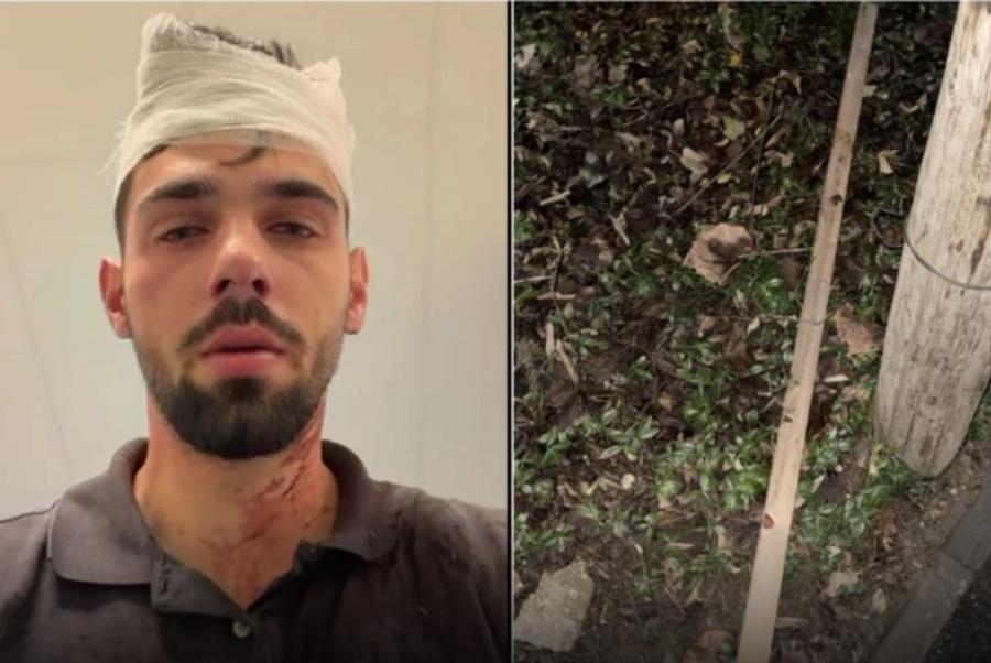 Tânărul bătut cu parul de doi jucători legați de Poli Timișoara e fiul unui fost fotbalist trecut și pe la Rapid