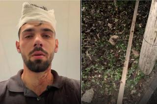 Șocant scandal! Doi fotbaliști de la Poli Timișoara, acuzați că au snopit în bătaie un tânăr de 19 ani: „Huliganii mi-au nenorocit copilul! Parul cu care l-au lovit e plin de sângele lui”