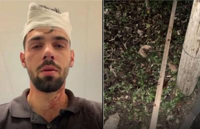 Șocant scandal! Doi fotbaliști de la Poli Timișoara, acuzați că au snopit în bătaie un tânăr de 19 ani: „Huliganii mi-au nenorocit copilul! Parul cu care l-au lovit e plin de sângele lui”