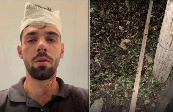 Șocant scandal! Doi fotbaliști de la Poli Timișoara, acuzați că au snopit în bătaie un tânăr de 19 ani: „Huliganii mi-au nenorocit copilul! Parul cu care l-au lovit e plin de sângele lui”