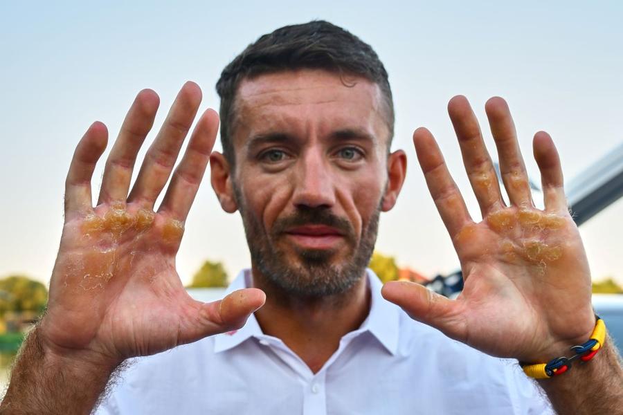 Așa arată mâinile lui Marian Enache după o cursă istovitoare Foto: Raed Krishan Mărturia emoționantă a lui Marian Enache despre cursa de aur olimpic de la Paris: „Urechile îmi piuiau, în capul meu era întuneric, nu mai vedeam bine. Totul fierbea în mine!”