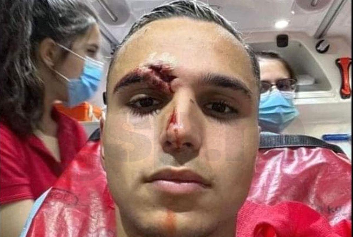 Ciocnire violentă între Cristi Manea și Naser Aliji