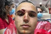 Desfigurat! FOTO-ȘOC din ambulanță: cum arată Cristi Manea, după faza care i-a îngrozit pe spectatorii din Gruia