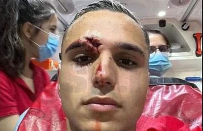 Desfigurat! FOTO-ȘOC din ambulanță: cum arată Cristi Manea, după faza care i-a îngrozit pe spectatorii din Gruia