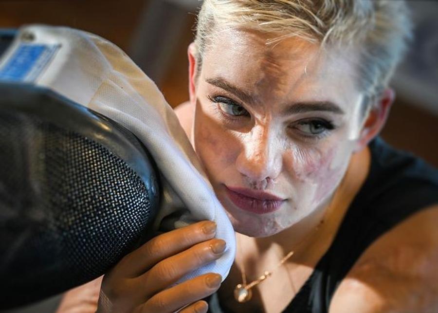 Bebe și cicatricile sale FOTO Instagram Scrimera Bebe Vio, dublă campioană la Jocurile Paralimpice din 2016 și 2020: „Povestea mea nu se bazează pe boala pe care am avut-o, ci pe sportul pe care-l practic!”