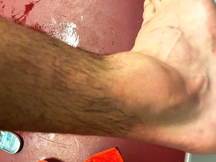 Glezna lui Vukcevic, după intrarea lui Maglica / foto: GSP Noul „chirurg” din Liga 1 vine de la CFR Cluj! Și-a scos din circuit adversarul după o intrare ORIBILĂ + e recidivist!
