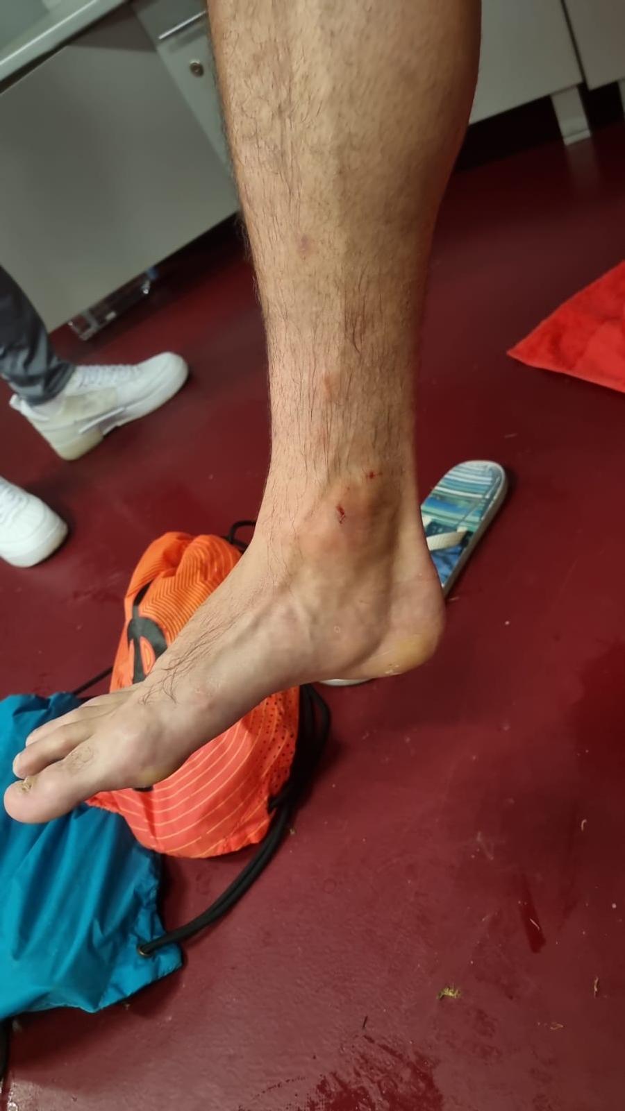 Glezna lui Vukcevic, după intrarea lui Maglica Cum arată jucătorii de la UTA după meciul cu CFR Cluj » Verdict în direct: „Trebuia dat penalty pentru arădeni”