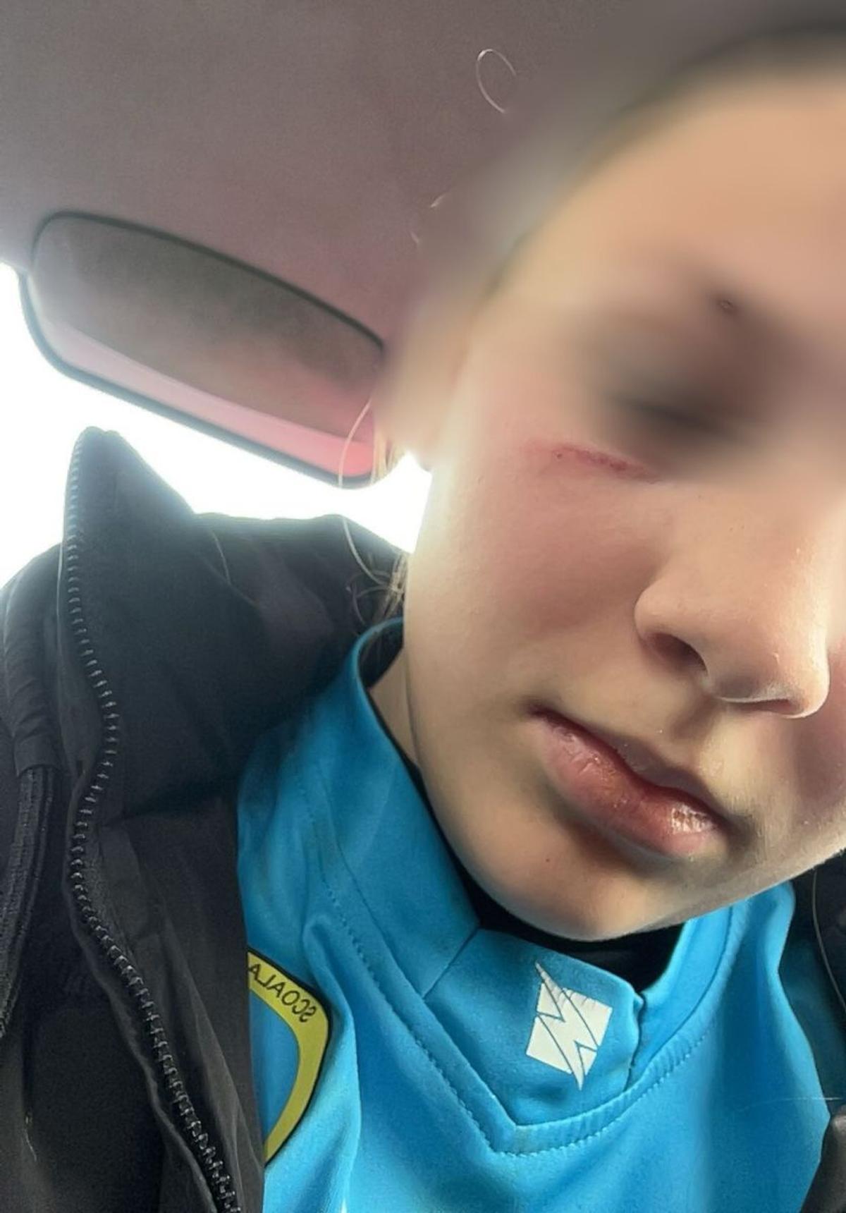 Scene șocante la un meci de fotbal din România » O jucătoare în vârstă de 14 ani, bătută de mama unui adversar chiar pe teren