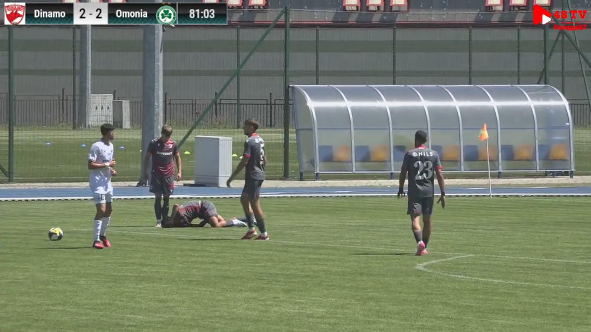 Antonio Bordușanu s-a accidentat în amicalul dintre Dinamo și Omonia