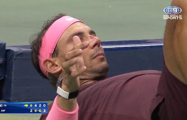 Cu nasul tăiat, Rafa Nadal s-a calificat în turul 3 la US Open » „Accidentat” de propria rachetă!