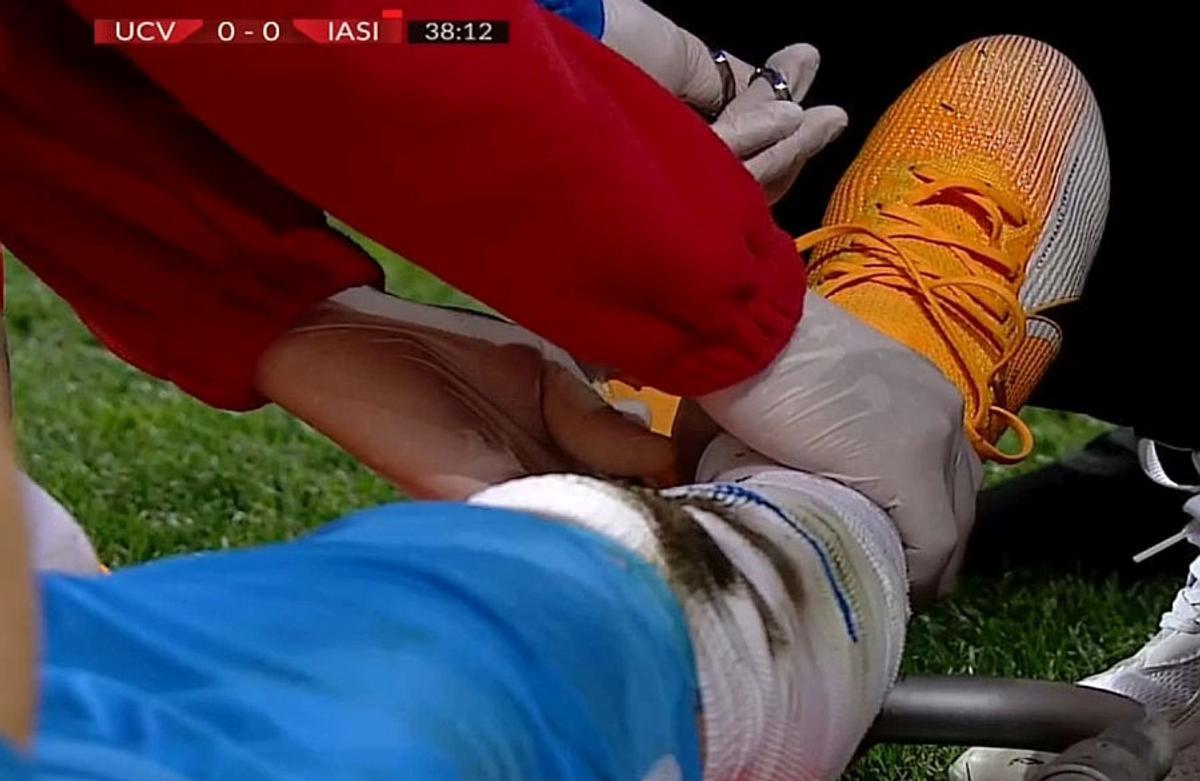 Accidentare Elvir Koljic - Craiova - Poli Iași / 2.10. 2020