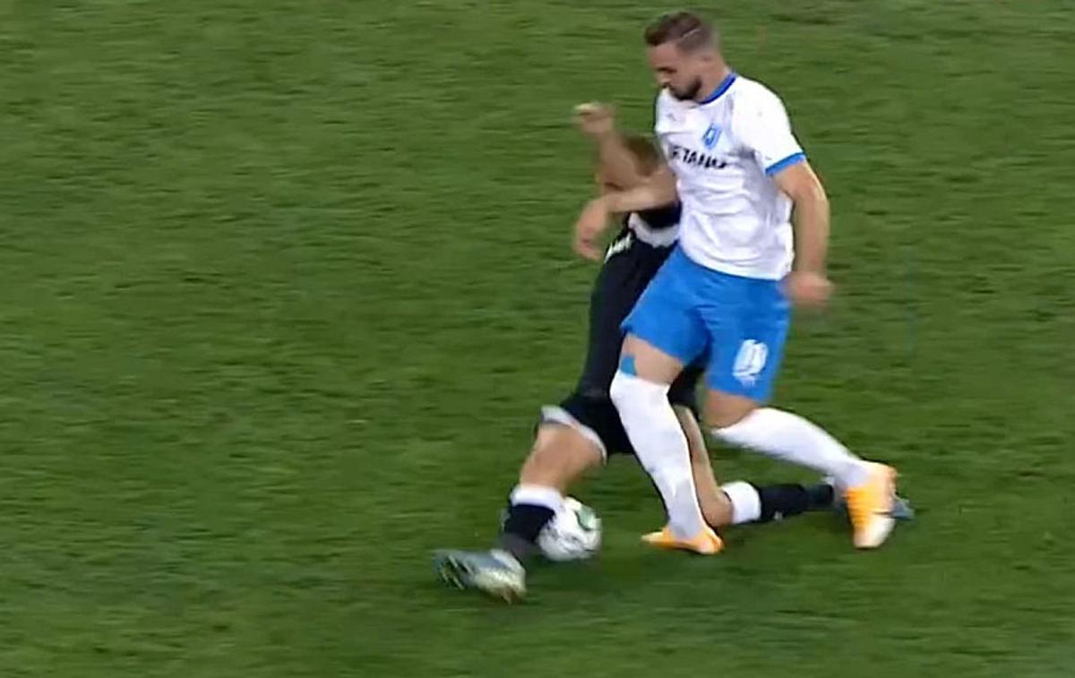 UPDATE VIDEO + FOTO Elvir Koljic, accidentare îngrozitoare în Craiova - Poli Iași! Cum arată radiografia jucătorului și care e diagnosticul