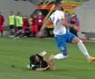 UPDATE VIDEO + FOTO Elvir Koljic, accidentare îngrozitoare în Craiova - Poli Iași! Cum arată radiografia jucătorului și care e diagnosticul