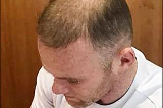 El este primul fotbalist care și-a asigurat părul! » „Am o singură parte a corpului pe care am vrut să o protejez”