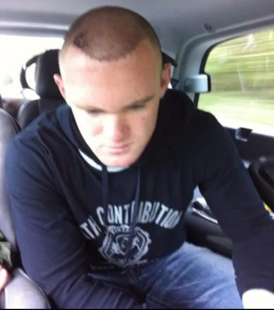 Wayne Rooney, după ultimul transplant de păr El este primul fotbalist care și-a asigurat părul! » „Am o singură parte a corpului pe care am vrut să o protejez”