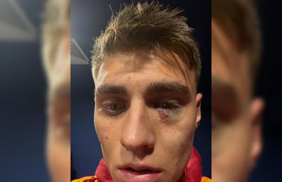 Scandal „bricheta” în Fenerbahce - Galatasaray! Lovit imediat după gol, sub privirile lui Lucescu