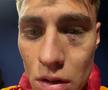 Scandal „bricheta” în Fenerbahce - Galatasaray! Lovit imediat după gol, sub privirile lui Lucescu