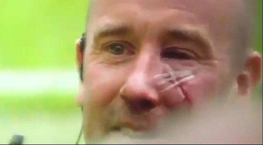 Polițistul tăiat pe față Reacții după incidentele de pe „Old Trafford”: „Puteau omorî pe cineva!” » Ce riscă Manchester United