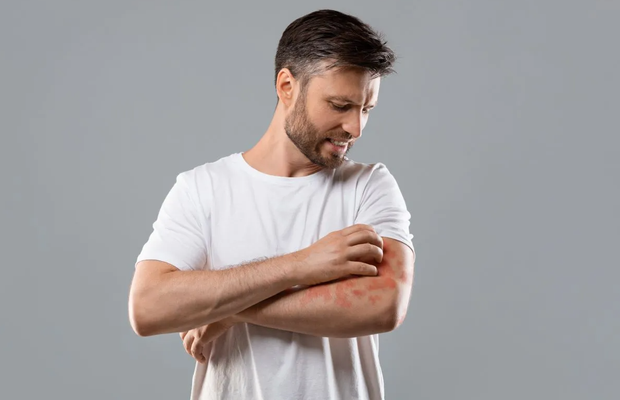 Sportul în aer liber și pielea: semnele pe care nu ar trebui să le ignori după expunerea repetată la soare