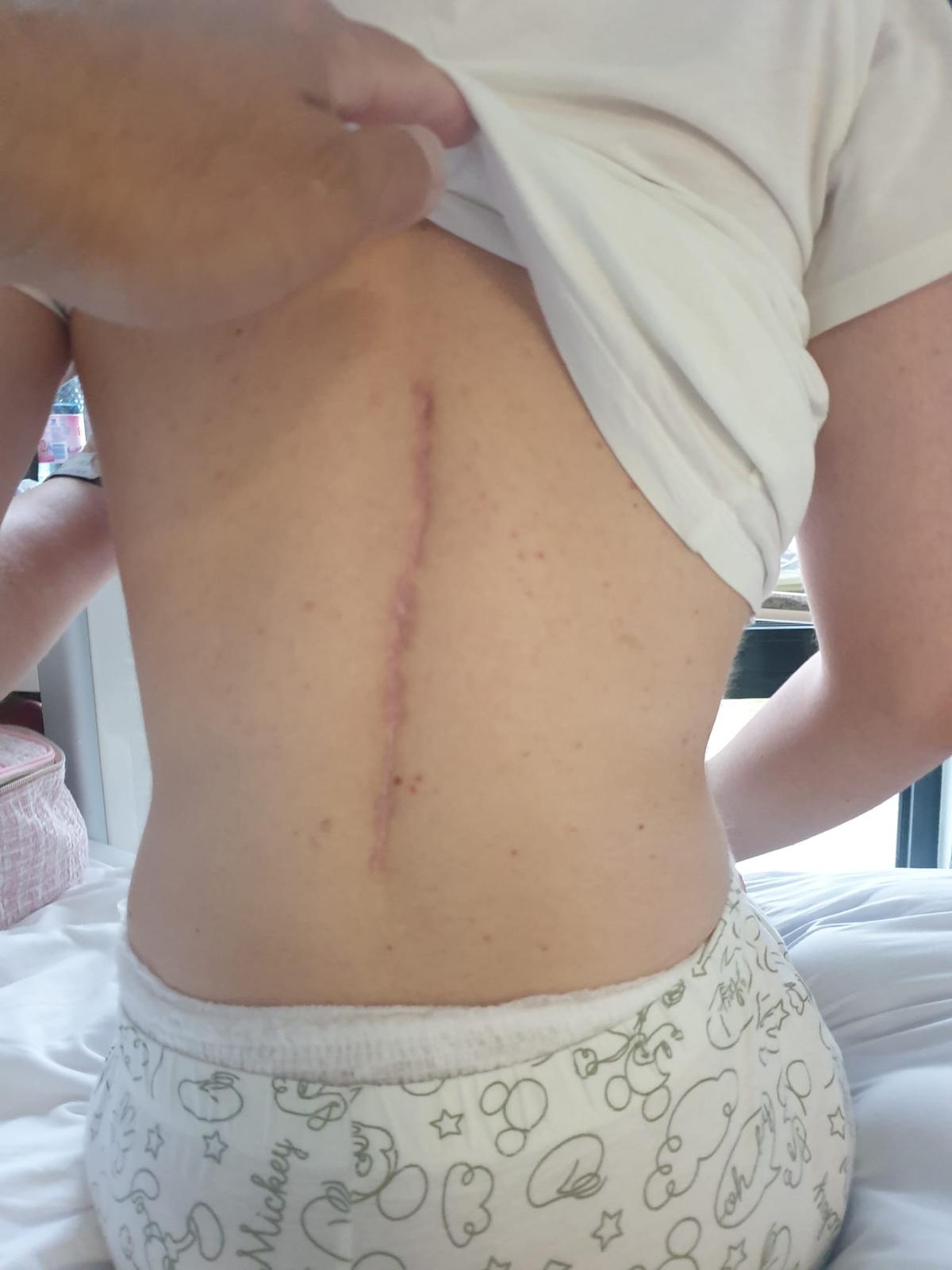 Și-a făcut arc din oase frânte! Povestea INCREDIBILĂ a Andei: „Eram studentă, un copac a căzut peste mine pe stradă” » A transformat ghinionul în vis olimpic: „Dacă eu pot, pot și ceilalți. Fără scuze!”