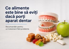 Ce alimente este bine să eviți dacă porți aparat dentar. Recomandări pentru un tratament fără probleme