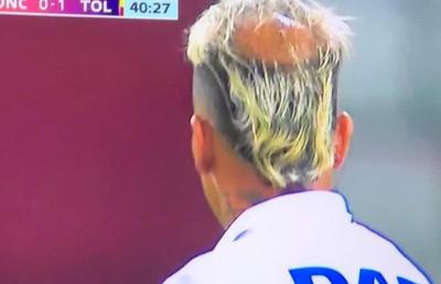 Fostul jucător de la FCSB a ajuns viral în țara natală » Afecțiunea de care suferă l-a transformat complet