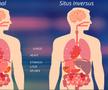 Situs inversus, anomalia congenitală în cadrul căreia anumite organe sunt situate în partea opusă față de situația normală / Sursă foto: HealthJade.net