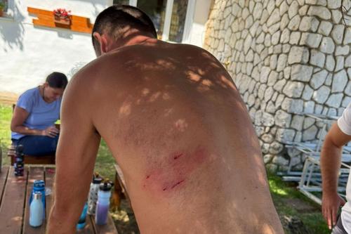 Călin Laza, atacat de 8 câini pe un traseu montan/Foto: Bihoreanul