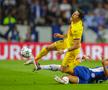 Primul verdict al medicilor la Barcelona, după ce Lewandowski a ieșit accidentat