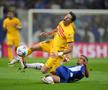 Primul verdict al medicilor la Barcelona, după ce Lewandowski a ieșit accidentat