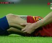 FOTO Florin Tănase, accidentare înaintea derby-urilor cu CFR Cluj și CS Universitatea Craiova