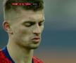 FOTO Florin Tănase, accidentare înaintea derby-urilor cu CFR Cluj și CS Universitatea Craiova