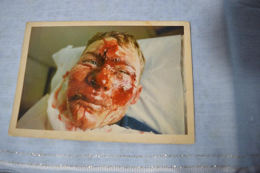 Povestea cutremurătoare a unui român care a șocat Mondialul: „Fața mea a fost pe post de frână, durerea nu poate fi descrisă”. Ce a urmat e de neimaginat: „Doctorul a cerut urgent o poză cu mine”