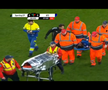 Primele imagini cu Antoine Baroan, după ce și-a rupt piciorul la debut