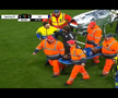 Primele imagini cu Antoine Baroan, după ce și-a rupt piciorul la debut