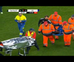 Primele imagini cu Antoine Baroan, după ce și-a rupt piciorul la debut