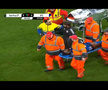 Primele imagini cu Antoine Baroan, după ce și-a rupt piciorul la debut