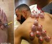 Și Karim Benzema s-a tratat cu ventuze pentru o mai bună refacere musculară / Foto: Instagram