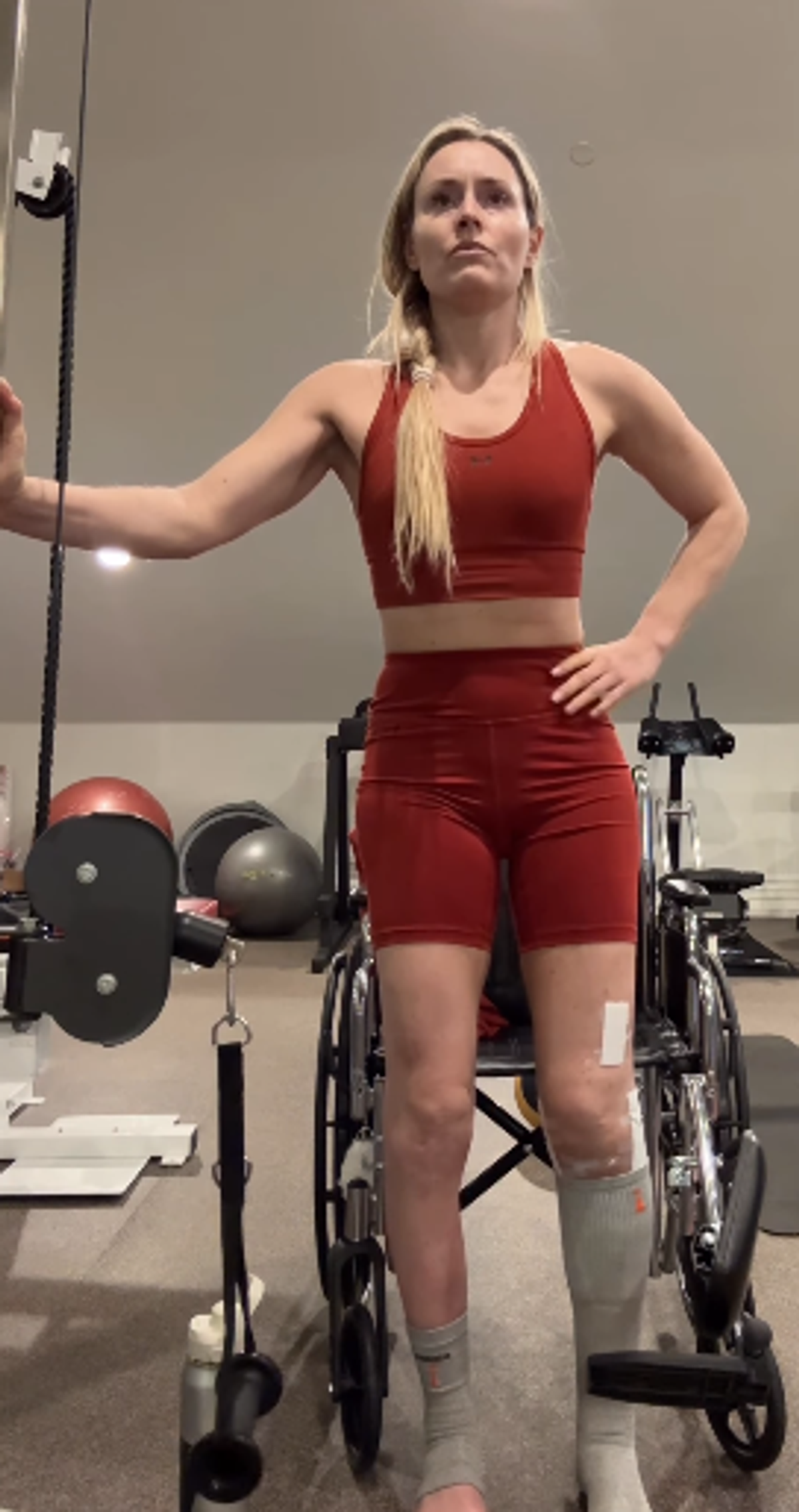 Lindsey Vonn a început recuperarea la picior