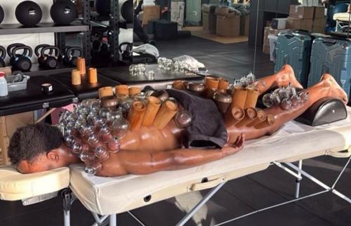 Louis Openda s-a tratat cu ventuze pentru o mai bună refacere musculară și eliminarea toxinelor din corp / Foto: Instagram