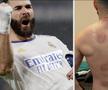 Și Karim Benzema s-a tratat cu ventuze pentru o mai bună refacere musculară / Foto: Instagram
