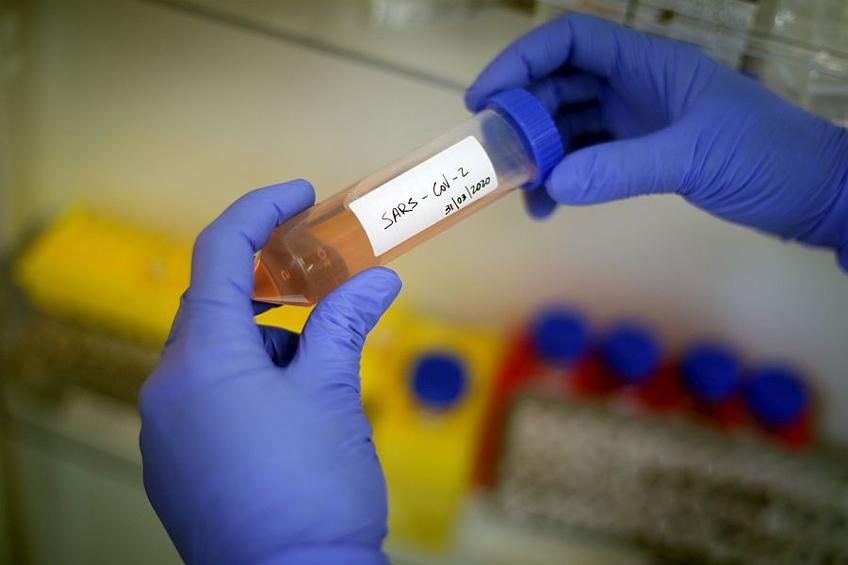 Cercetătorii fac tot mai multe descoperiri despre noul coronavirus // FOTO: Guliver/GettyImages
