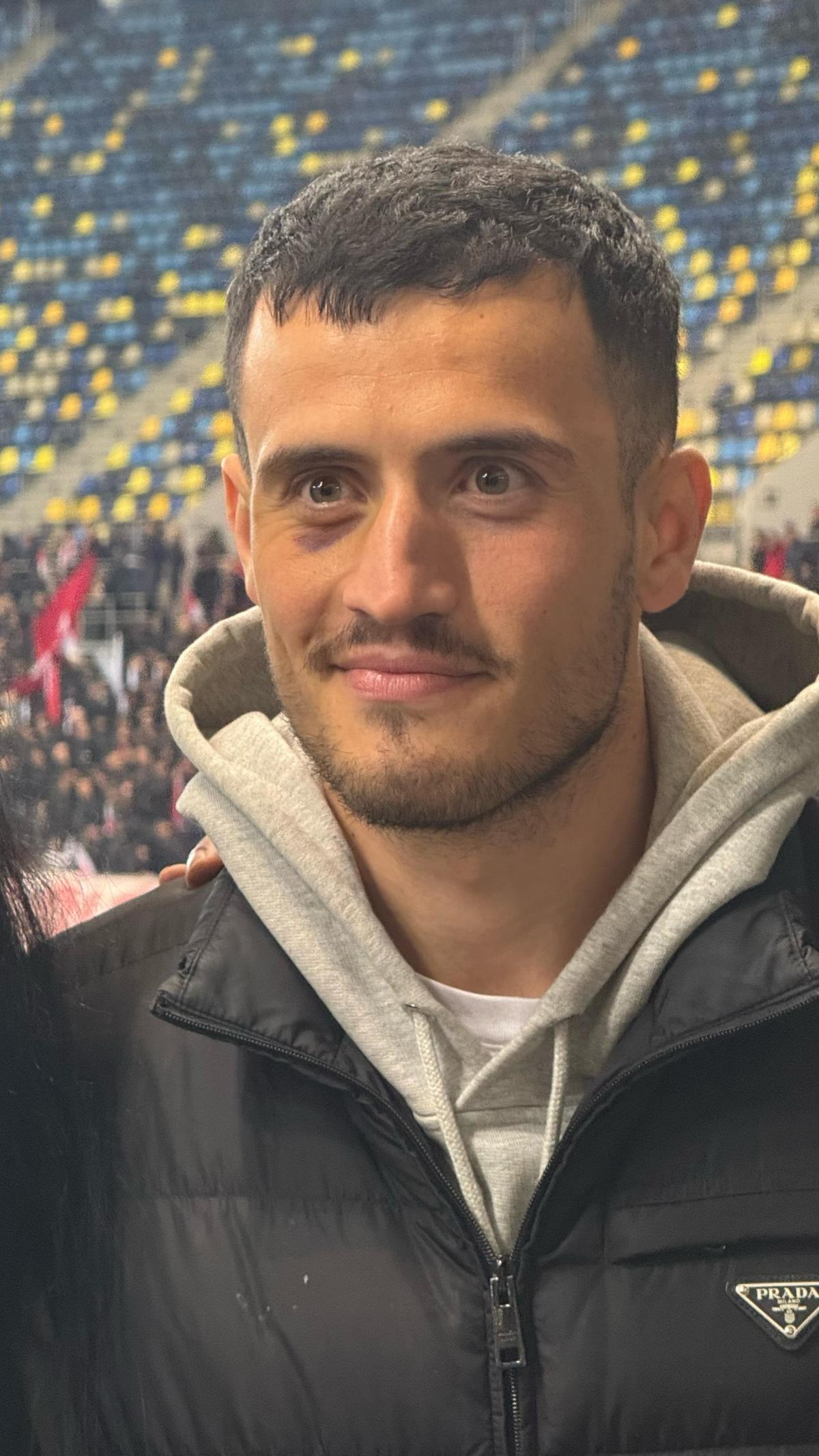 Încă se văd urmele loviturii lui Crețu! Cum a apărut Astrit Selmani la Rapid - Dinamo