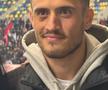 Încă se văd urmele loviturii lui Crețu! Cum a apărut Astrit Selmani la Rapid - Dinamo