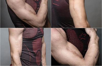 Durere și artă » Piloții din MotoGP așa cum nu i-ai mai văzut » S-au dezbrăcat și își arată cicatricile șocante, dar și tatuajele spectaculoase