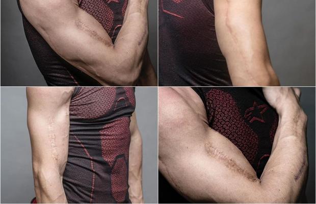 Durere și artă » Piloții din MotoGP așa cum nu i-ai mai văzut » S-au dezbrăcat și își arată cicatricile șocante, dar și tatuajele spectaculoase