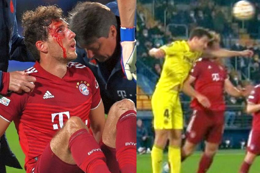 VAR-ul n-a intervenit în Villarreal - Bayern, deși Goretzka era plin de sânge