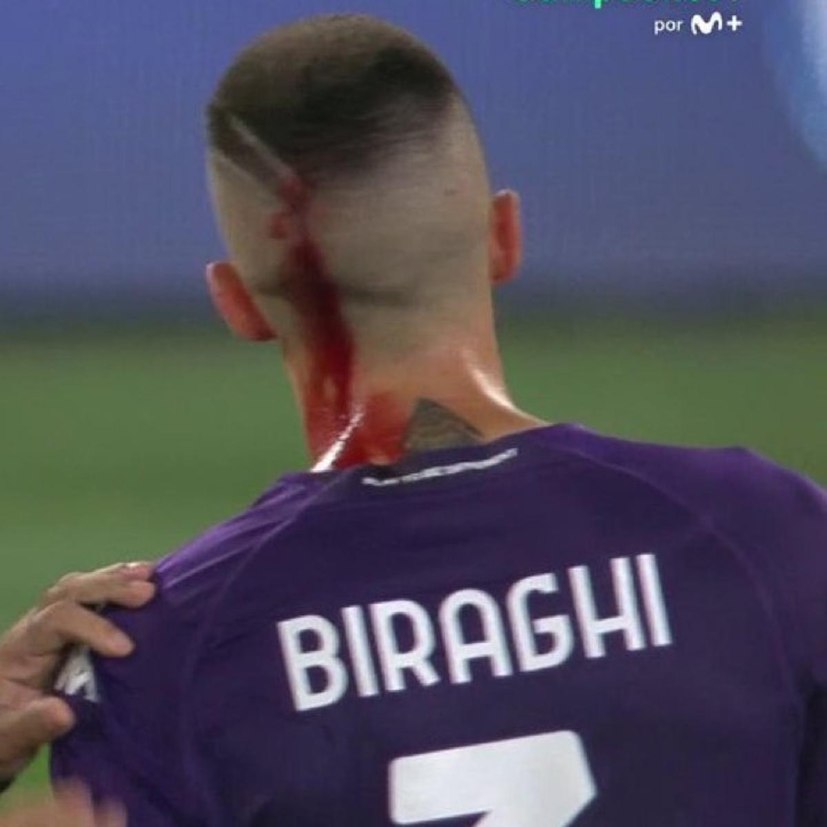 Imagini șocante din finala Conference League: ultrașii i-au spart capul unui fotbalist